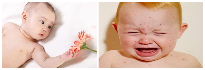 兒童濕疹反反復復，您有在家安裝家用除濕產品嗎？